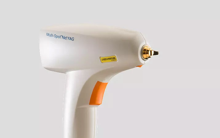 Multi-Spot Nd:YAG